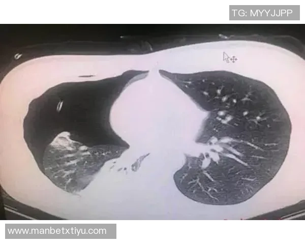 马绍尔赛前更衣室事件真相大白原因竟是上厕所引发热议